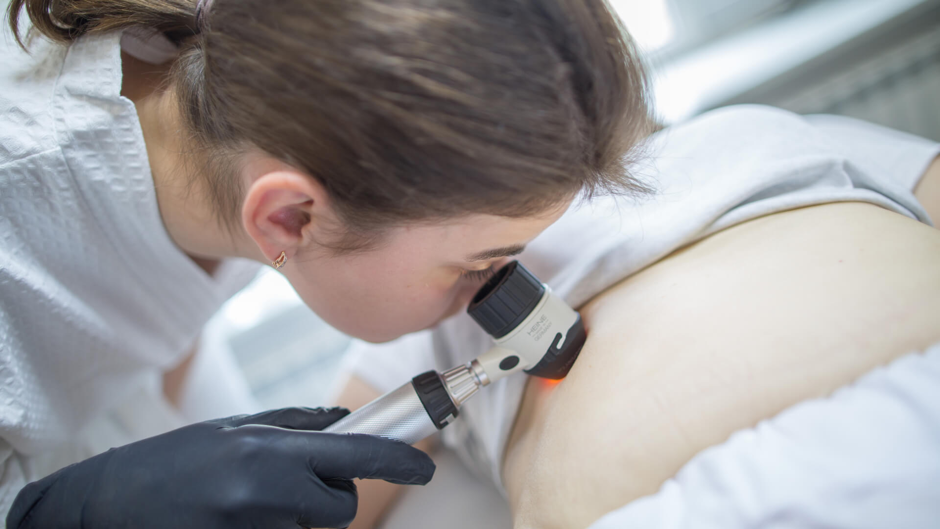 Перевірка та видалення родимок